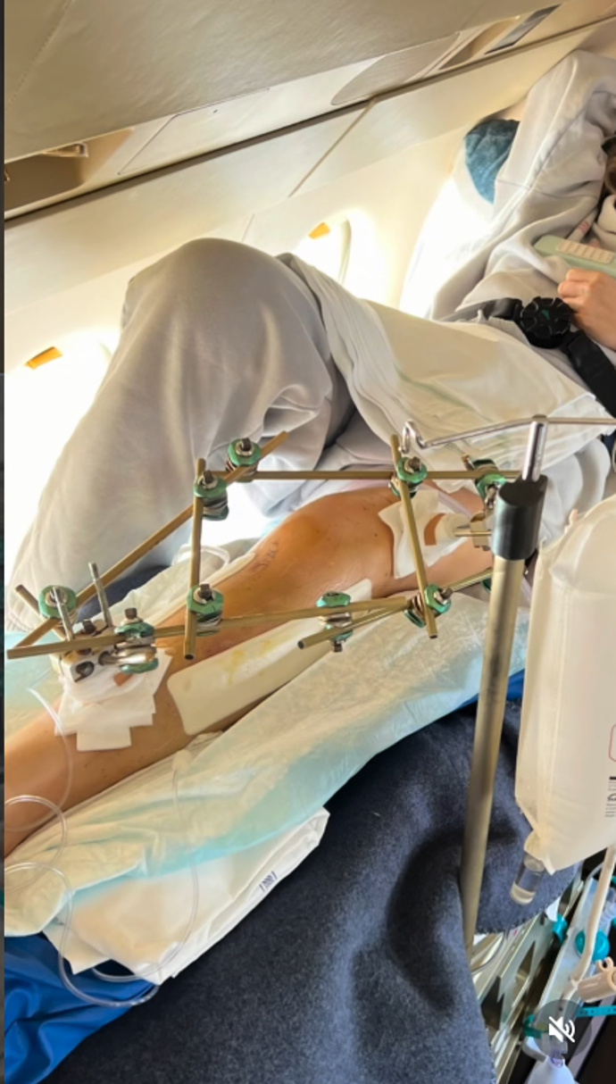 FOTO: Lindsey Vonn má nohu na maděru. – stránka 6