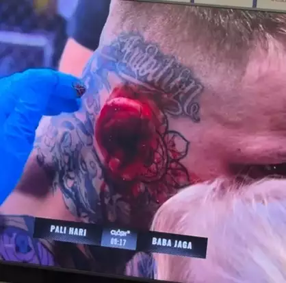 FOTO: Václav Mikulášek a jeho pokousané ucho.