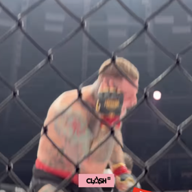 Václav Mikulášek se drží za ucho, do kterého ho kousnul Pali Hari. 