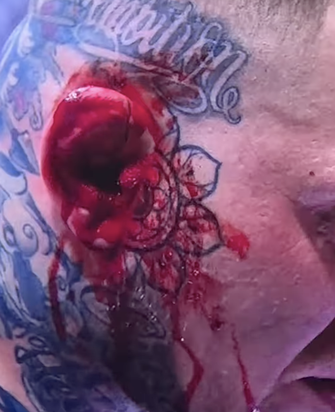 FOTO: Pokousané ucho Václava Mikuláška.