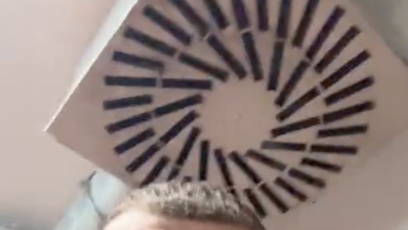 FOTO: Václav Mikulášek musel na šití.