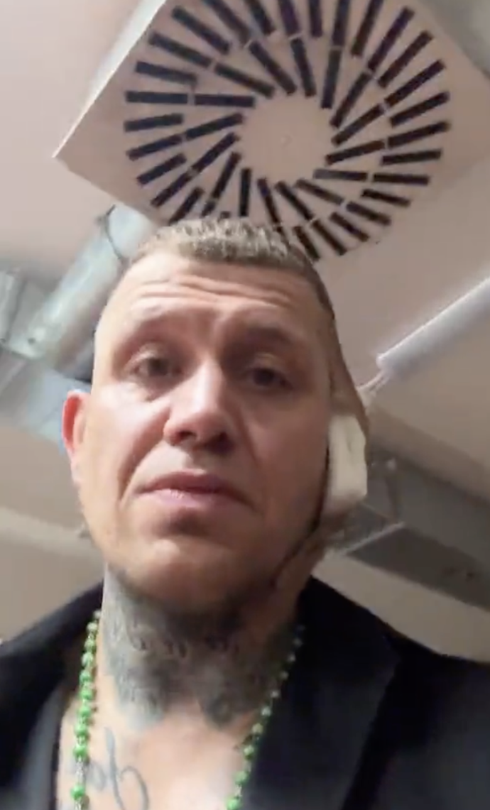 FOTO: Václav Mikulášek musel na šití. – stránka 5