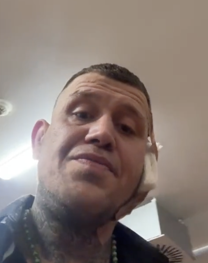 FOTO: Václav Mikulášek musel na šití. – stránka 4