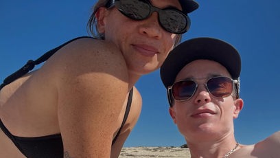 FOTO: Elliot Page má po operaci stále viditelné jizvy.