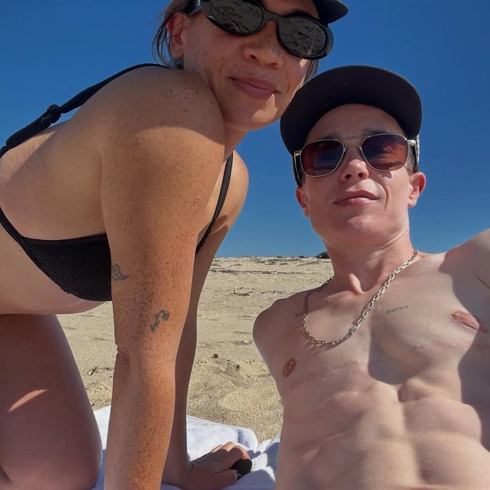 FOTO: Elliot Page má po operaci stále viditelné jizvy.