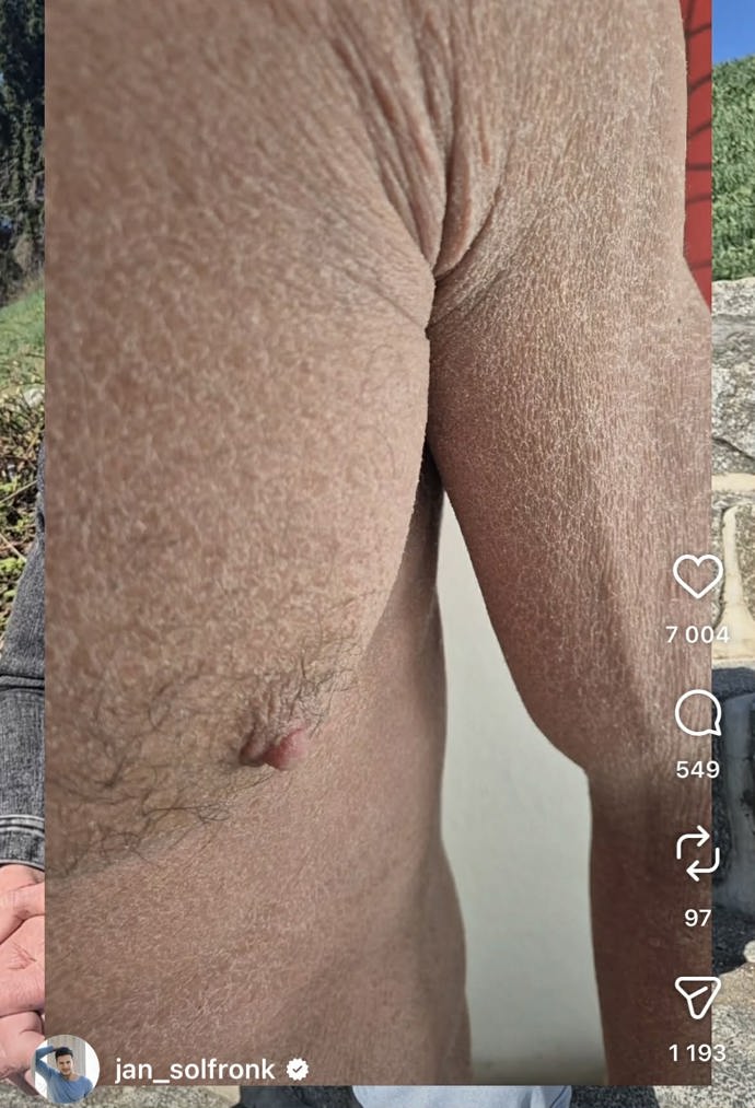 FOTO: Jan Solfronk bojoval v posledních měsících s vážnými zdravotními problémy. – stránka 5