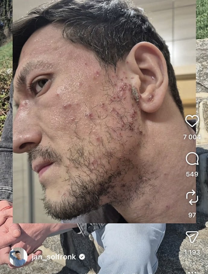 FOTO: Jan Solfronk má za sebou asi nejtěžší období v životě. – stránka 2
