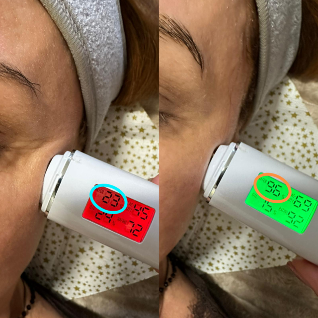 Jak pečovat o pleť po čtyřicítce