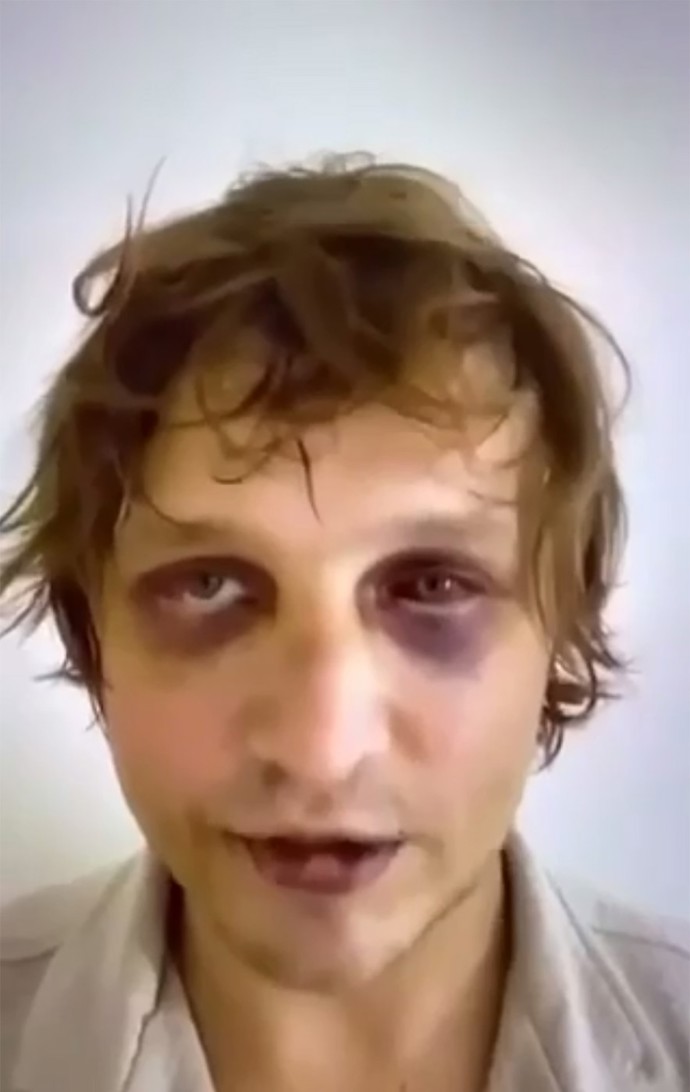 FOTO: Komarov byl několik dní mučem aby pachatelé získali výkupné. – stránka 1