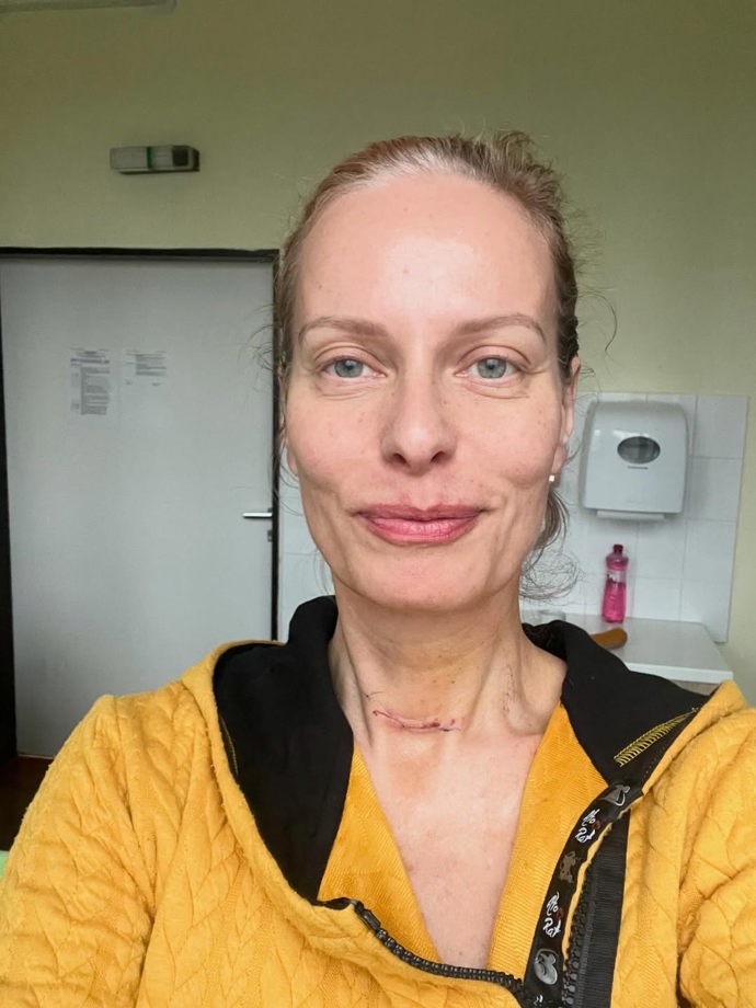 FOTO: Kristina Kloubková ukázala jizvu po operaci. – stránka 7