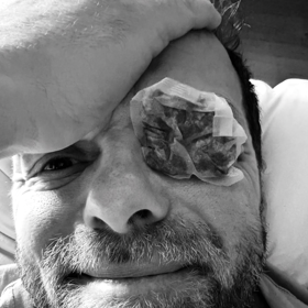 Lukáš Langmajer ukázal zalepené oko.