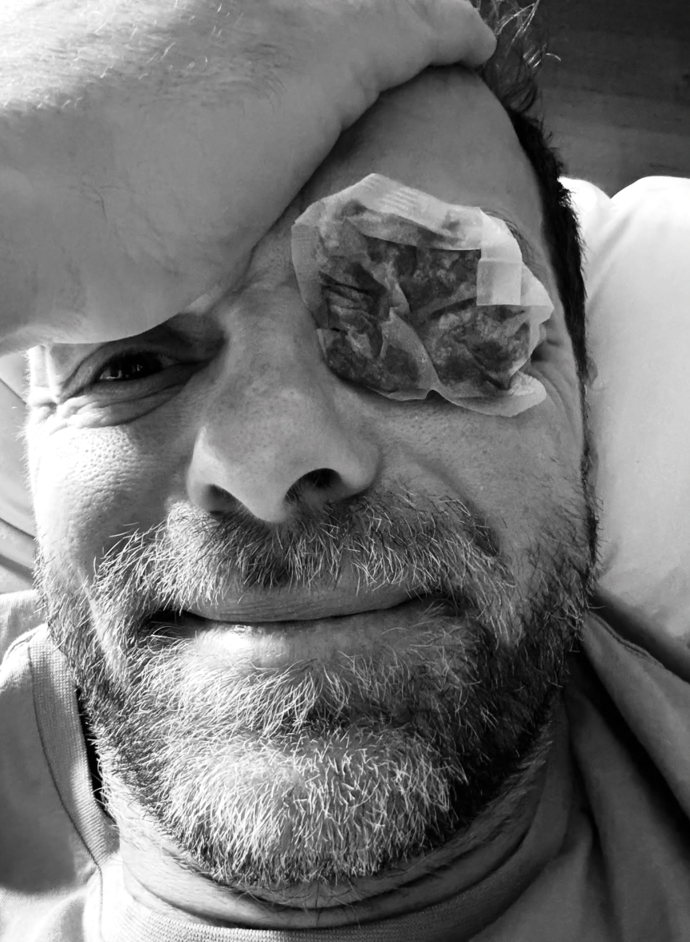 FOTO: Lukáš Langmajer ukázal zalepené oko.