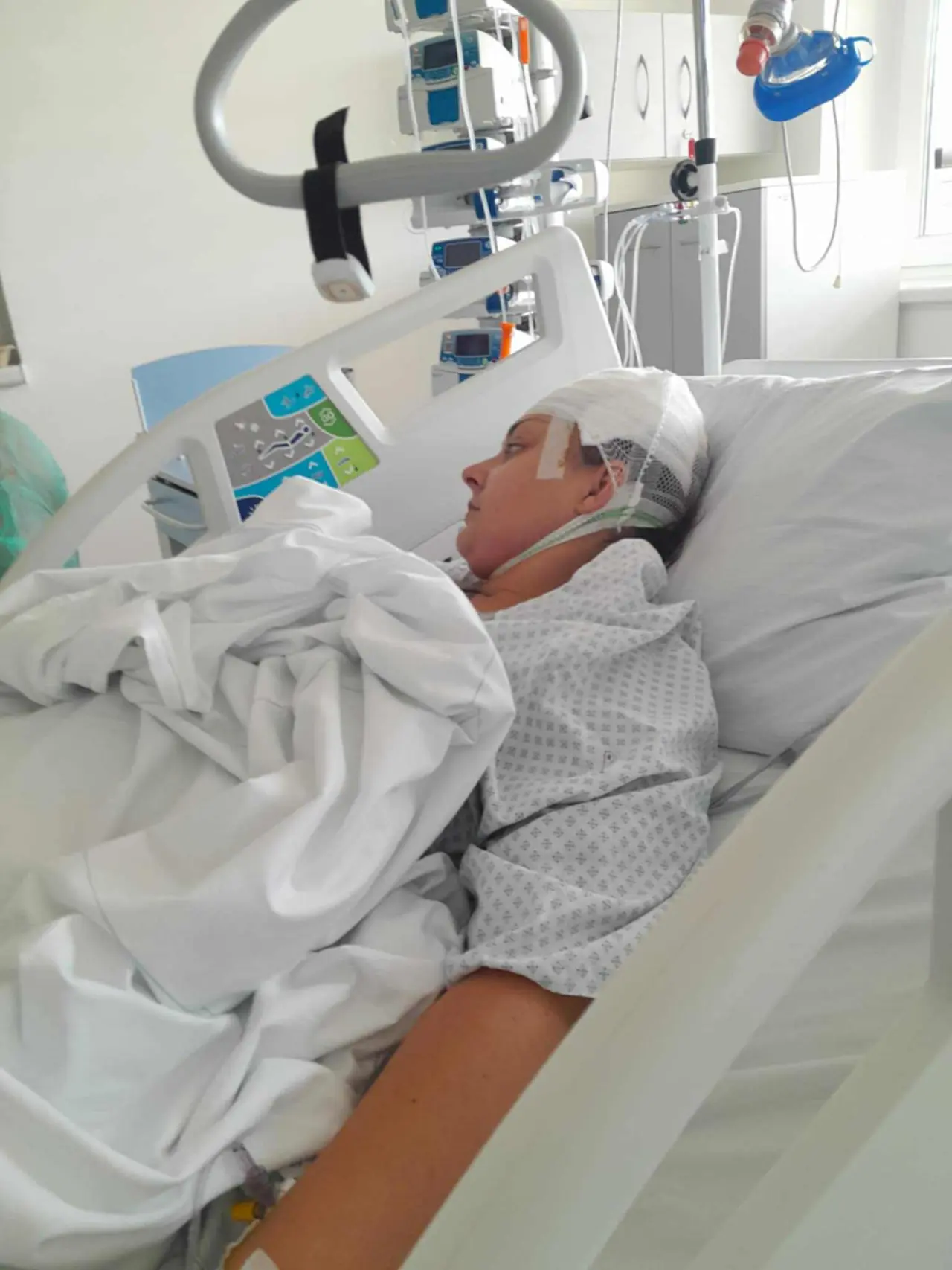 FOTO: Maminka Viki po operaci nádoru na mozku.