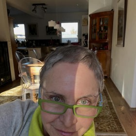 Herečce lékaři objevili hned pět zhoubných nádorů a museli jí operativně odstranit polovinu prsu.