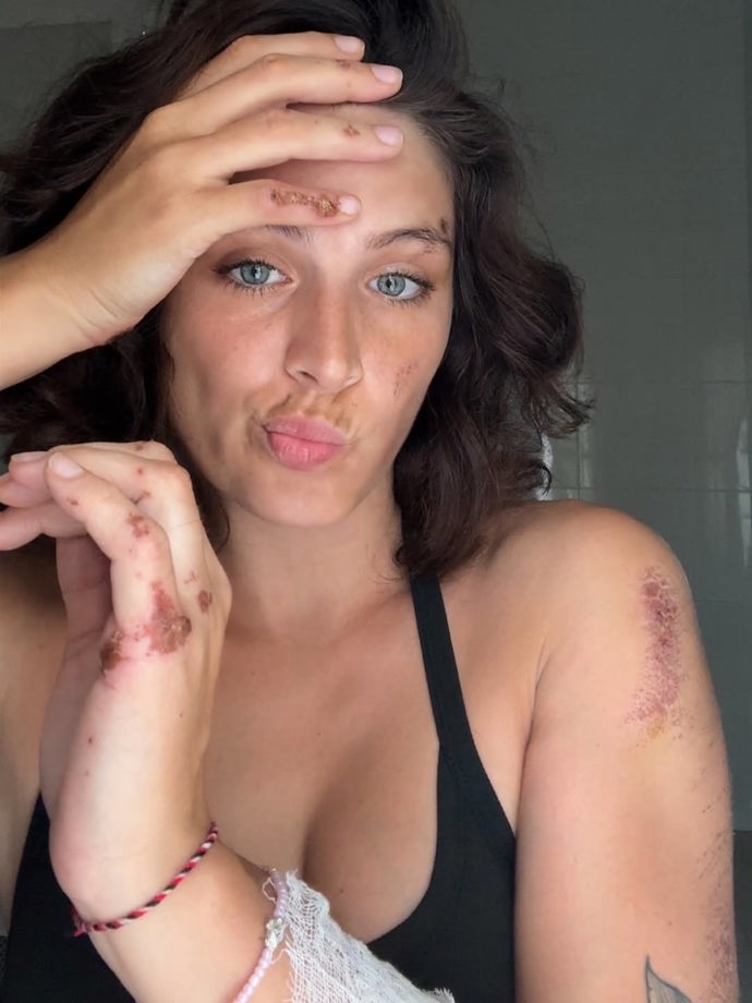 FOTO: Paulína Boško už se z n ehody zotavuje.