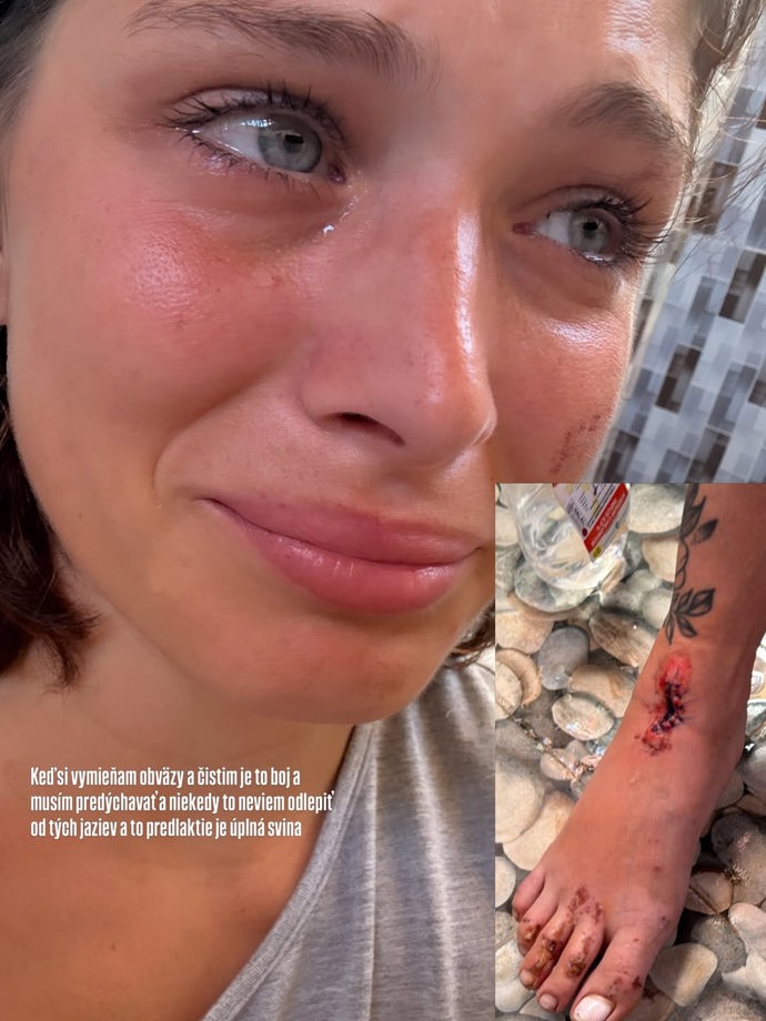 FOTO: Paulína Bošková měla nehodu na motorce. – stránka 4