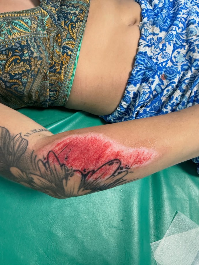 FOTO: Odřeniny na rukou. – stránka 2