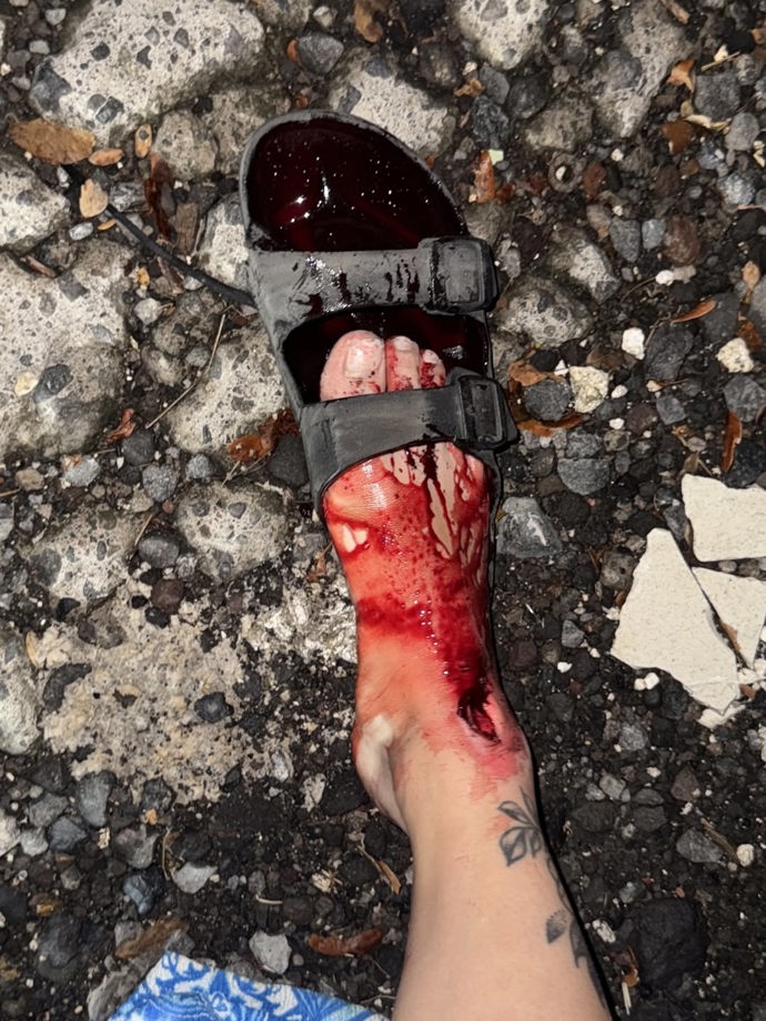 FOTO: Následky nehody Paulíny Boško. – stránka 1