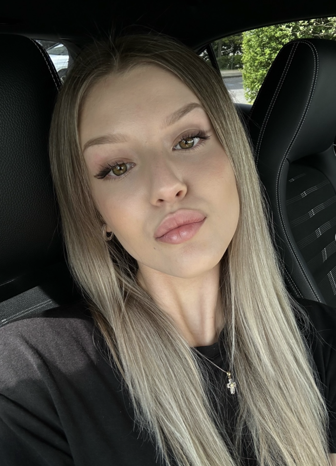 FOTO: Natálie Jirásková schytala kritiku za údajné plastiky. – stránka 3