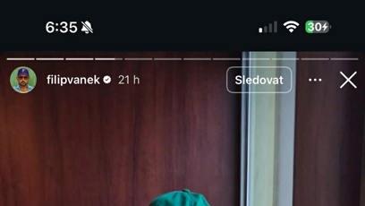 FOTO: Filip Vaněk odkryl tajemství Superstar.