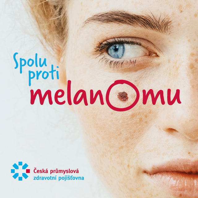 ČPZP: Lékaři opět vyšetří znaménka zdarma v 15 městech