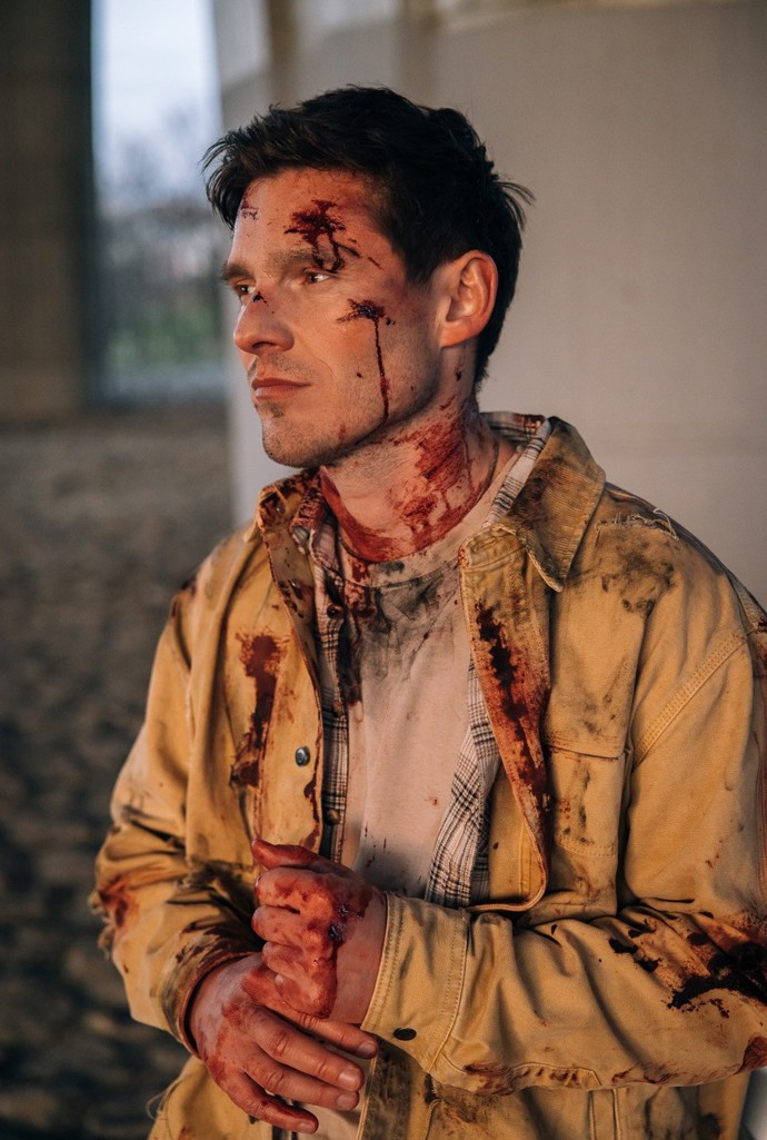 FOTO: Zpěvák si při natáčení novinky sáhl na absolutní dno svých hereckých limitů.