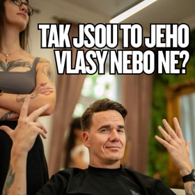 S řídnutím vlasů má problém až 85 procent mužů na světě. 