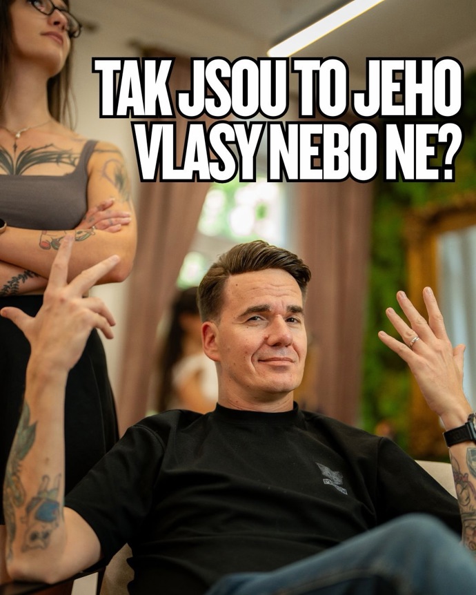 FOTO: S řídnutím vlasů má problém až 85 procent mužů na světě. – stránka 4