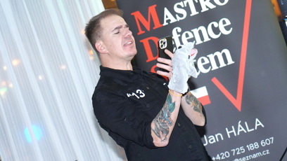FOTO: Dominik Turza bojuje s vypadáváním vlasů.