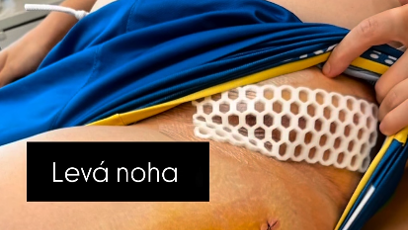 FOTO: Adam Choma podstoupil další operaci.