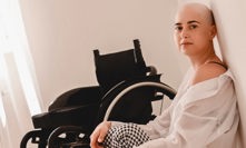 Erika Bartošová má od 12 let neoperovatelný nádor v míše.