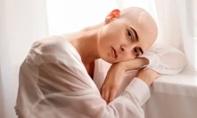 Erika Bartošová už nemůže kvůli nemoci chodit.