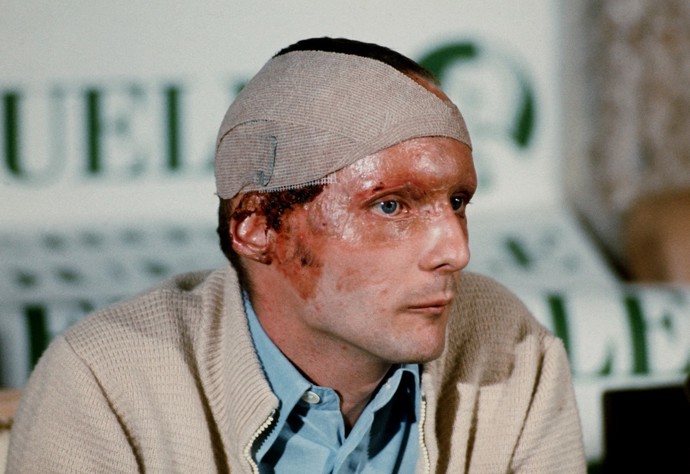 FOTO: Niki Lauda závodění miloval. – stránka 1