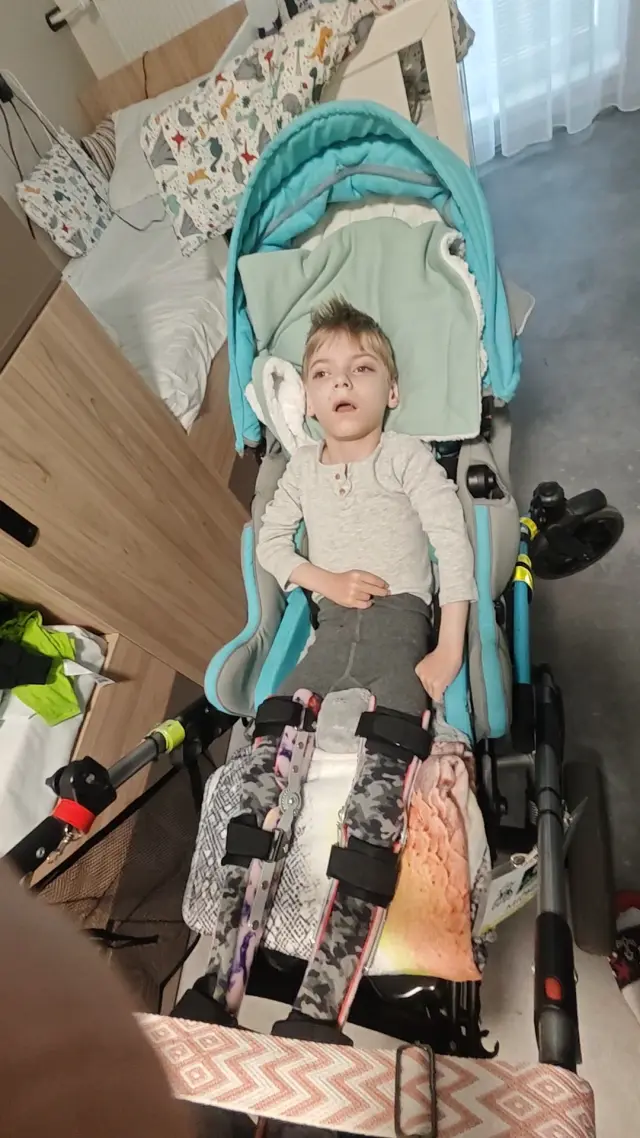 FOTO: Malý Michálek bojuje o život každý den.
