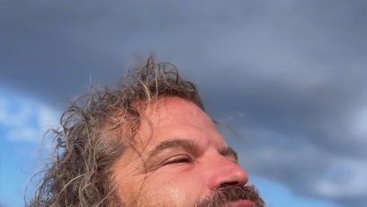 FOTO: Josef Maršálek ukázal nateklou pusu.