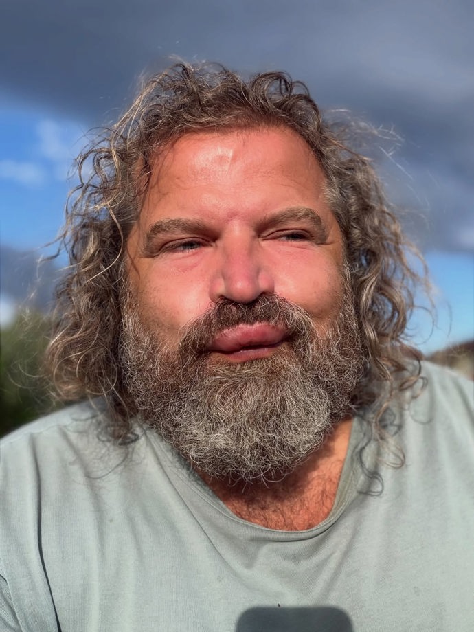 FOTO: Josef Maršálek s oteklou pusou.