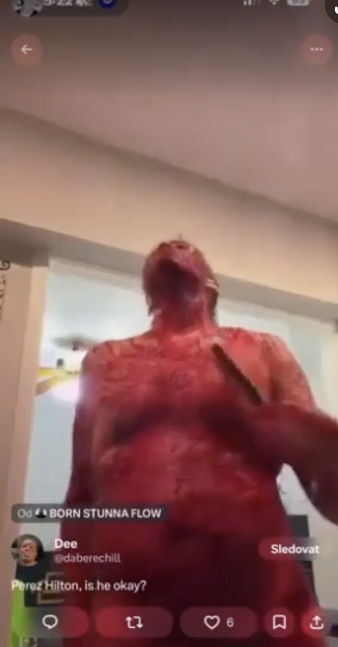 FOTO: Perez Hilton už je nyní prý stabilizovaný.