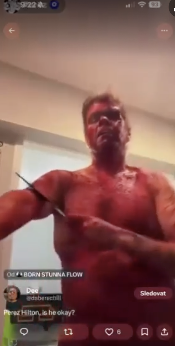 FOTO: Fanoušci měli o Pereze velký strach. – stránka 2