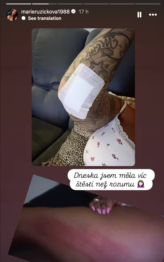 FOTO: Zranění Marie