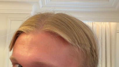 FOTO: Erling Haaland si ze své proměny utahoval.