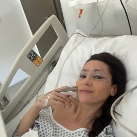 Tereza Kerndlová dvě hodiny po operaci víček.