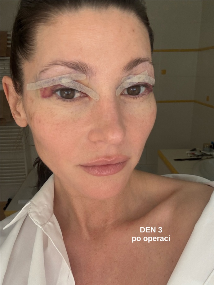 FOTO: Tereza Kerndlová sdílela fotky před a po. – stránka 2