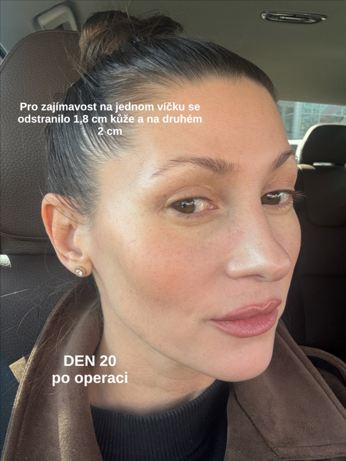 FOTO: Tereza Kerndlová po operaci. – stránka 3